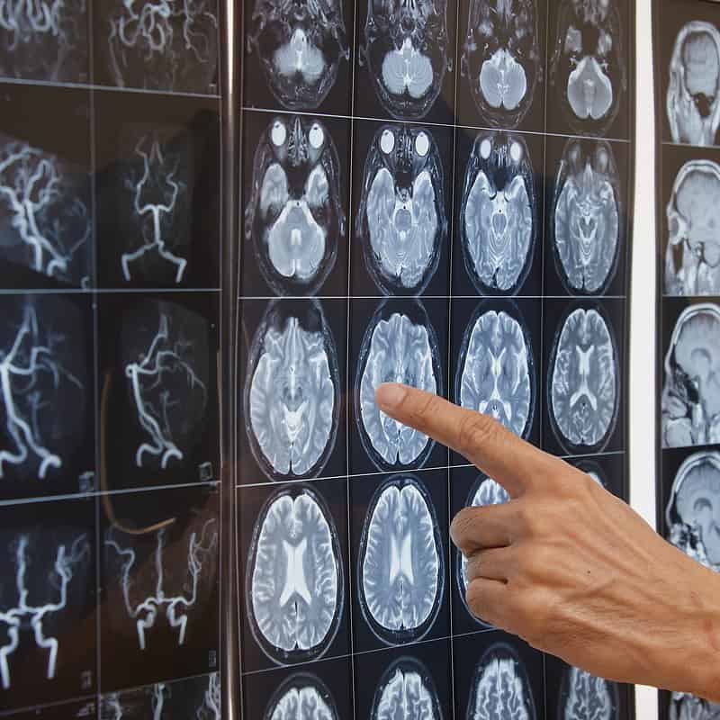 A man pointing at MRI images for research.