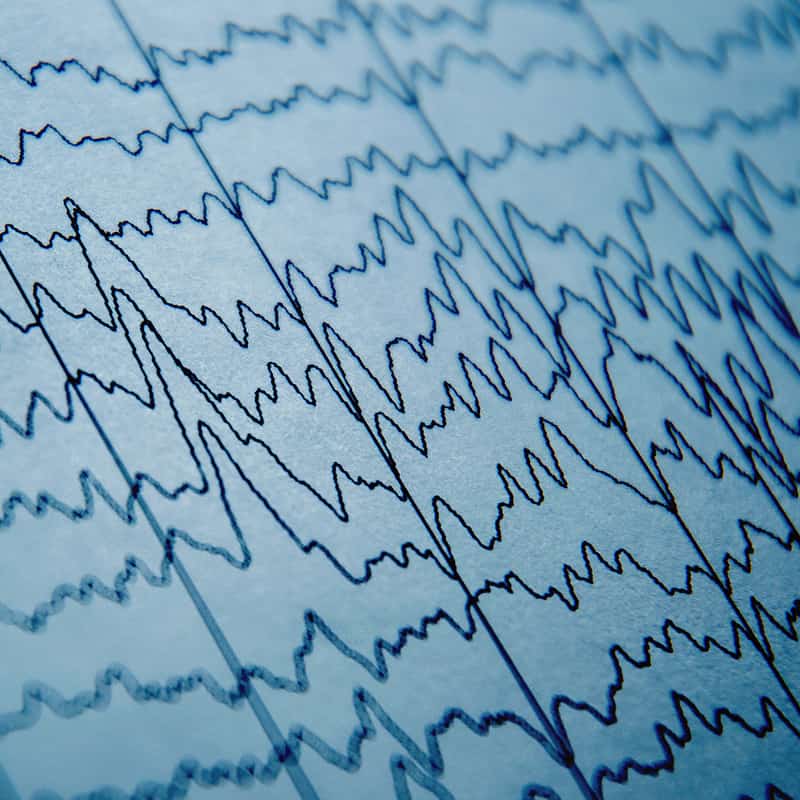 A close up of an ecg chart highlighting neurotechnology advancements in data mining.